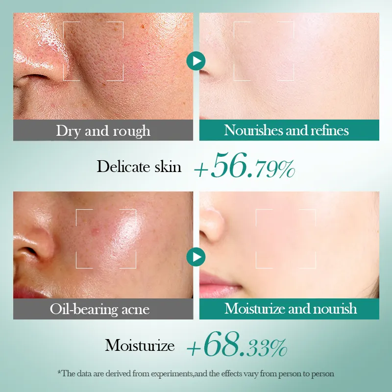 OEM Private Label BIOAQUA Hyaluronic Acid Moisturizing Repair Set Korean Natural Hydra Serum Facial Skin Care Face Cream Lotion