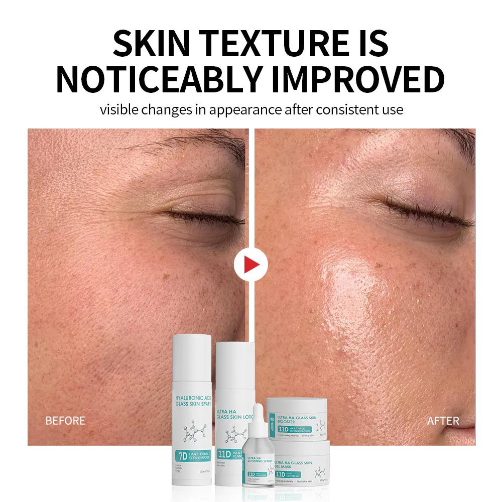 GMPC Factory Hyaluronic Acid Bifida Ferment 5 Piece Skincare Set Toner Serum Lotion Cream Facial Sheet Soothing MoCRA Ready