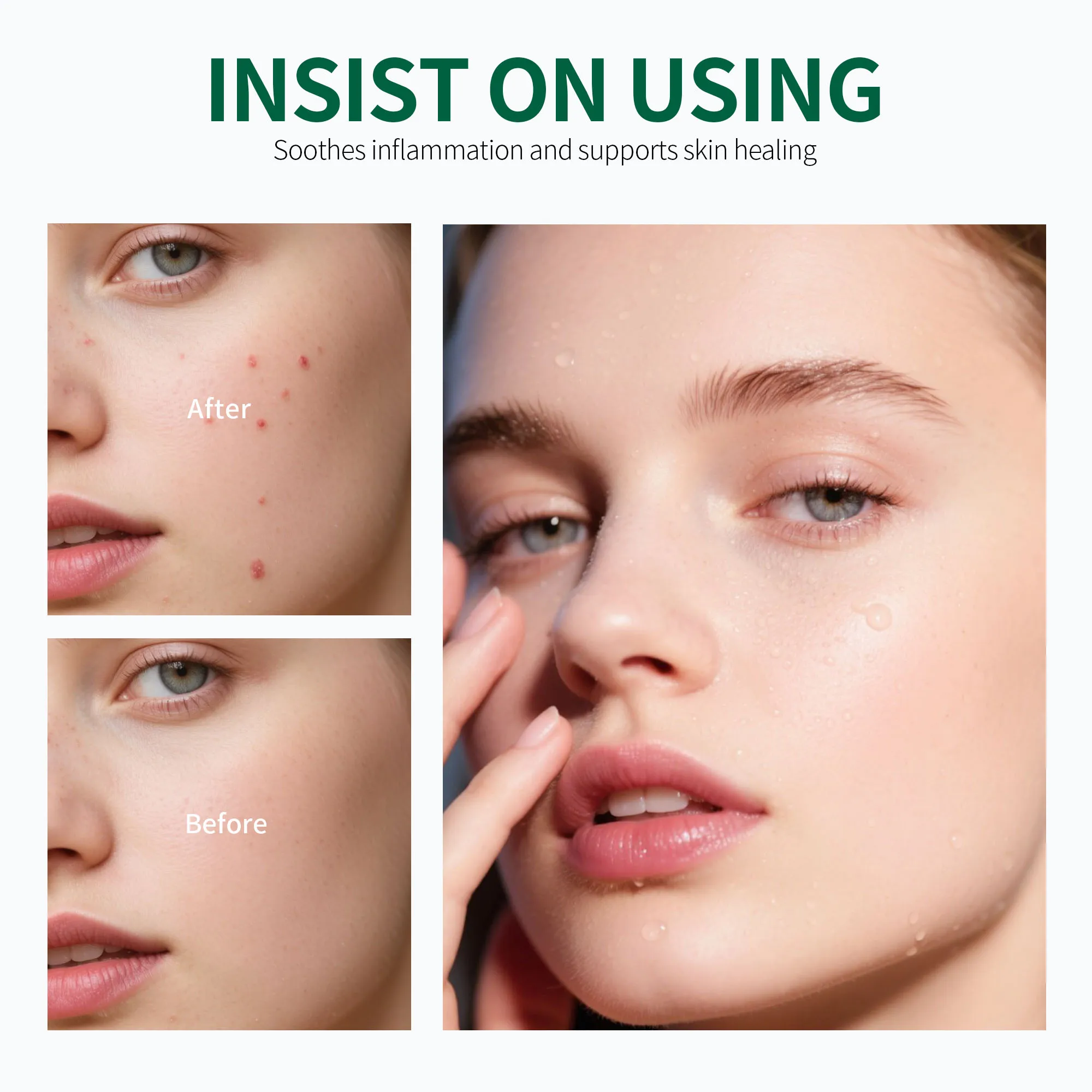 Private Label Acne Control Regimen Set Hyaluronic Acid Amino Acids + Ceramides Hydrating Moisturizer Salicylic Acid Zinc for Oil