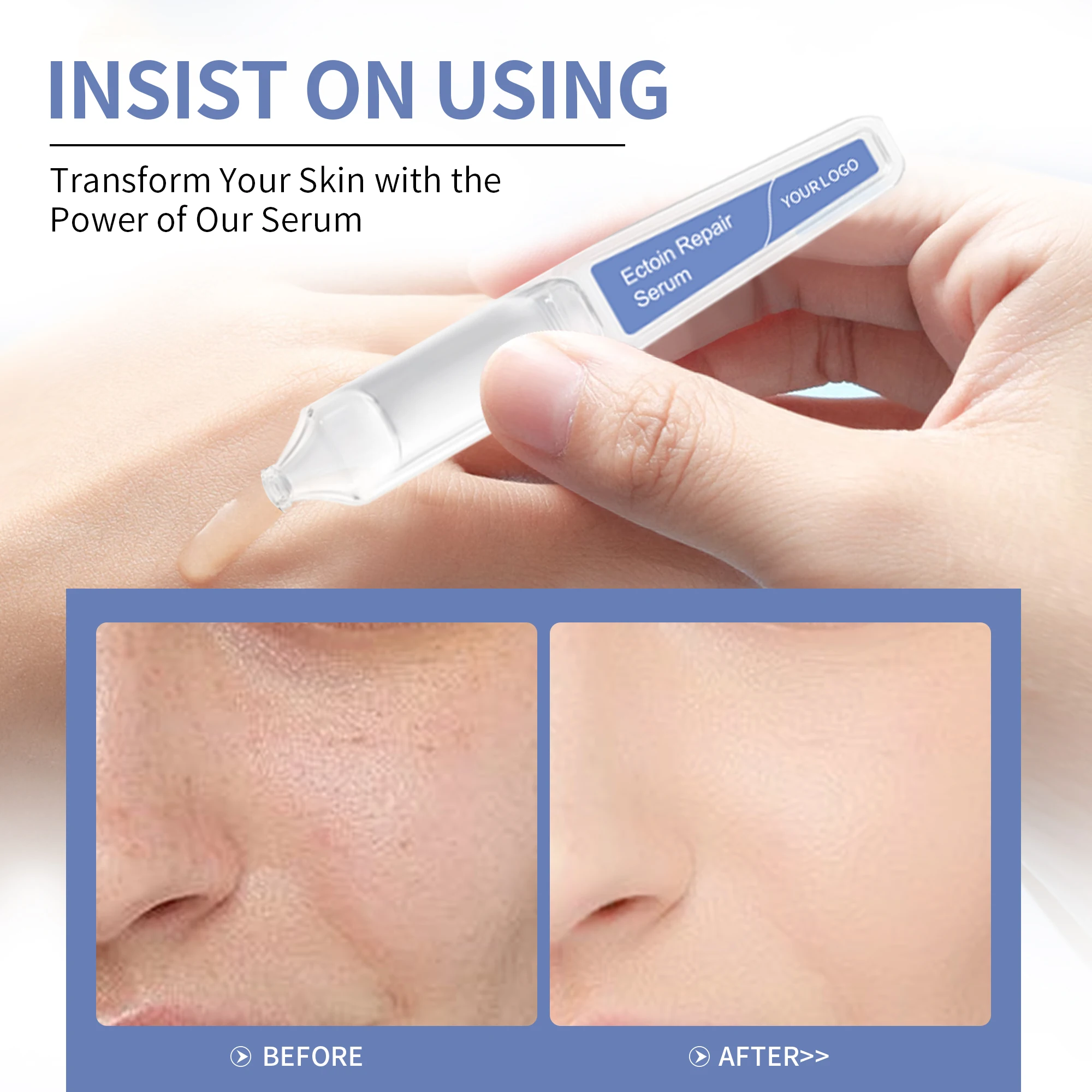 Wholesale Ectoin Skin Barrier Repairing Facial Serum Capsules with Beta-Glucan Calming for Sensitivity or Irritation