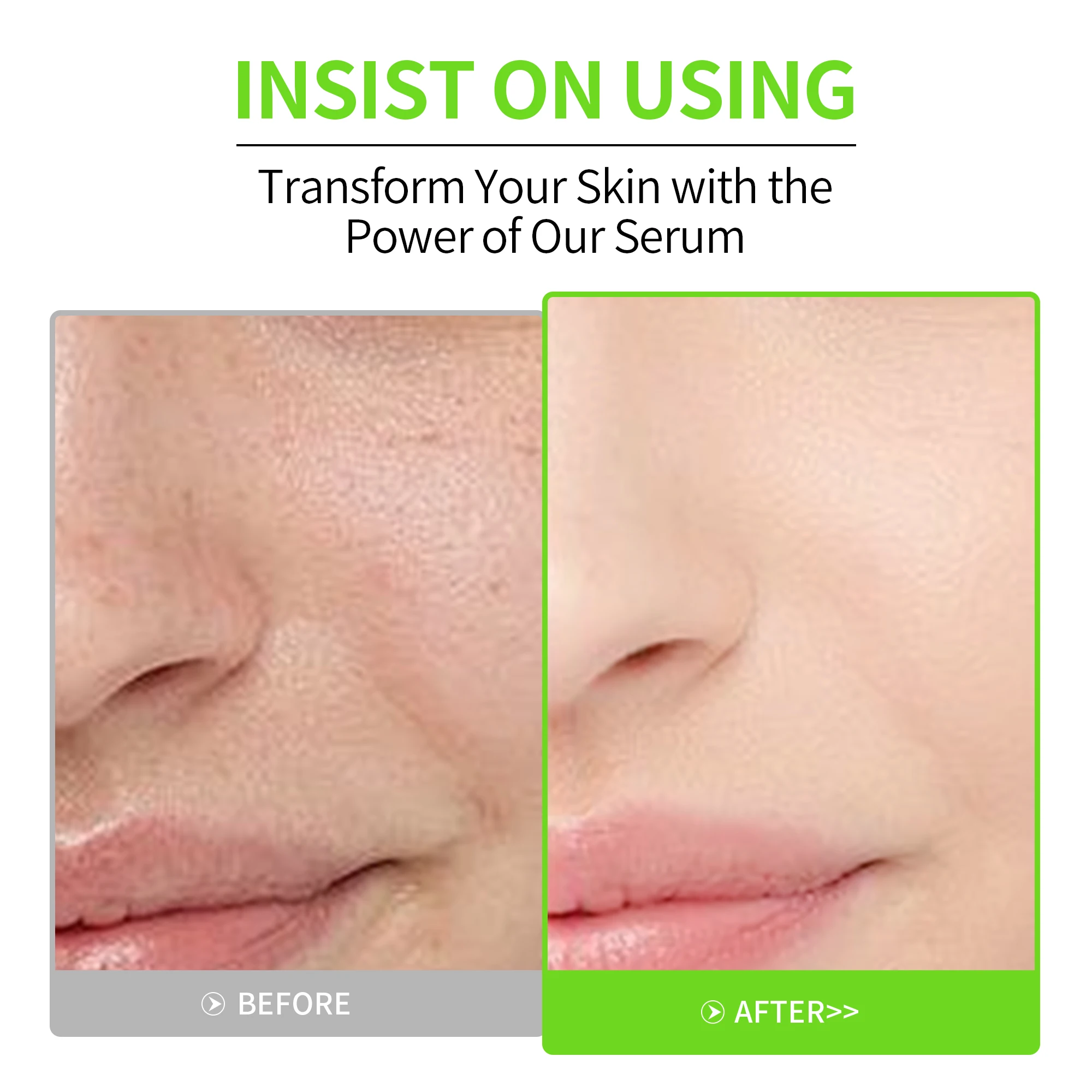 Apple Anti-Aging Face Serum with CoQ10 for Dark Spots and Fine Wrinkles | Krone Skin Care Manufacturer