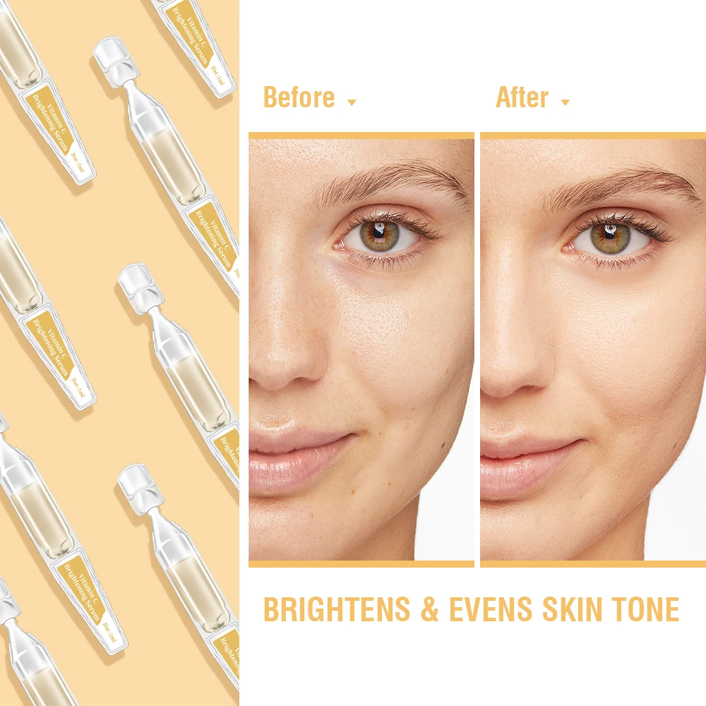 Kongrong OEM Custom BFS Safe Skincare Whitening Brightening Vitamin C Dark Spot Freckle Arbutin Face Care Facial Ampoules Serum